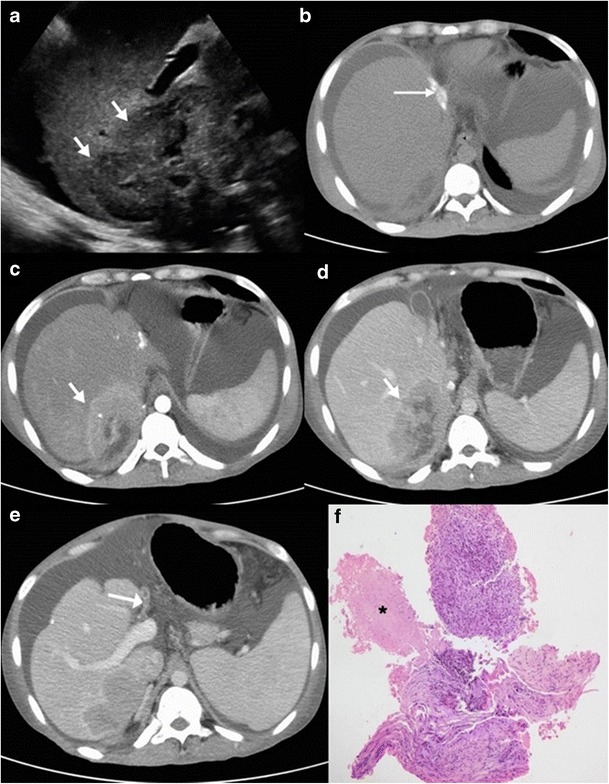 Fig. 14