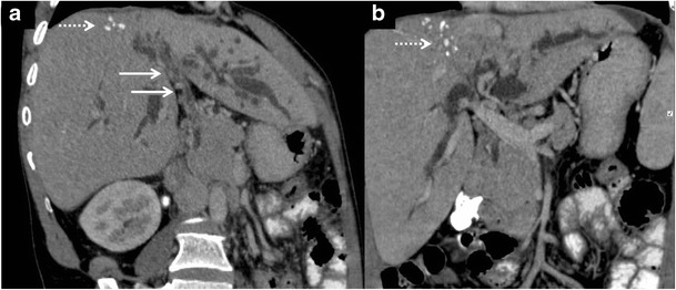 Fig. 17