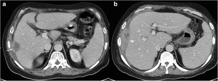 Fig. 13