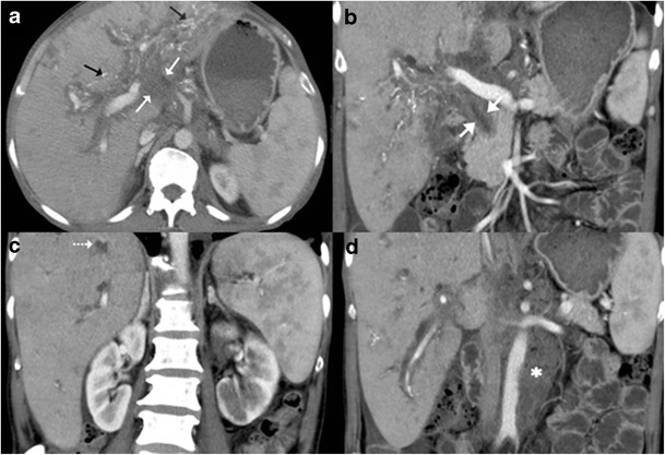 Fig. 19