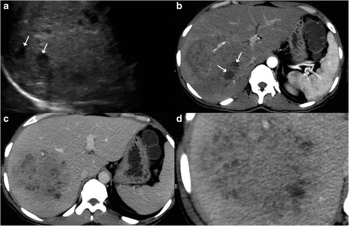 Fig. 10