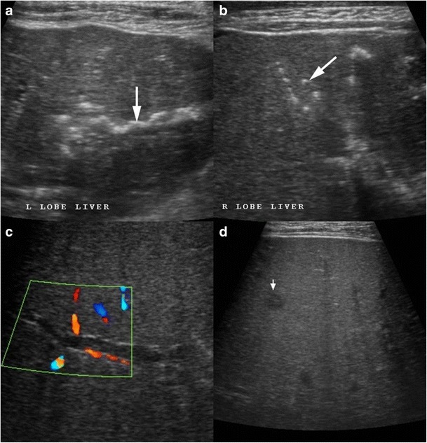 Fig. 18