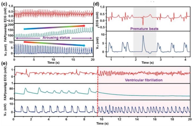 Figure 35