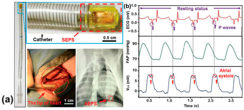 Figure 35