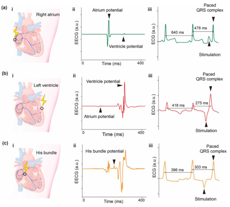 Figure 18