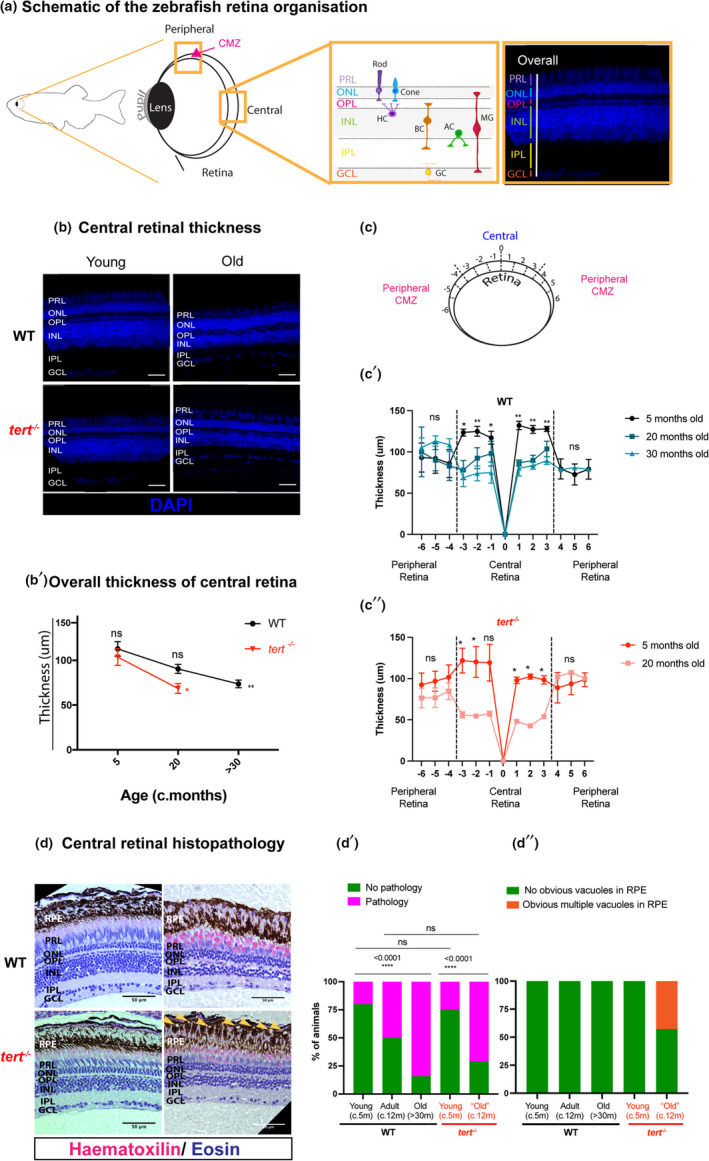 Müller Glia maintain their regenerative potential despite degeneration ...