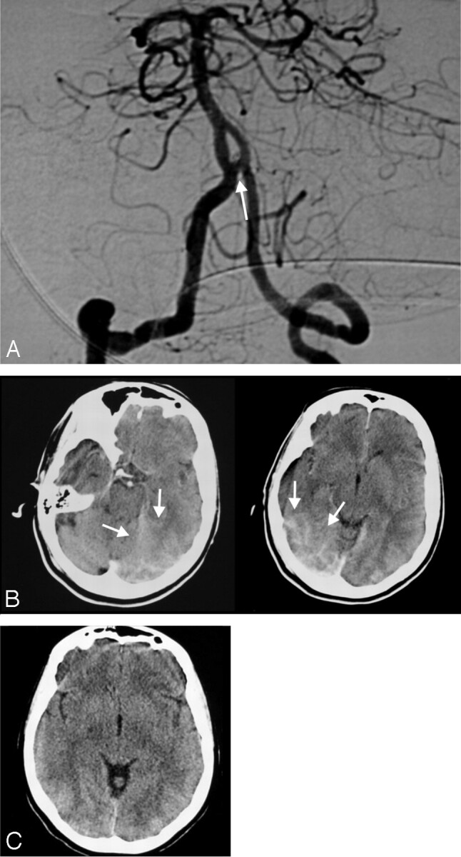 Fig 3.