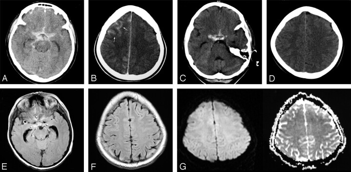 Fig 5.