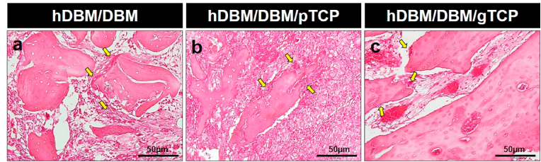 Fig. 11