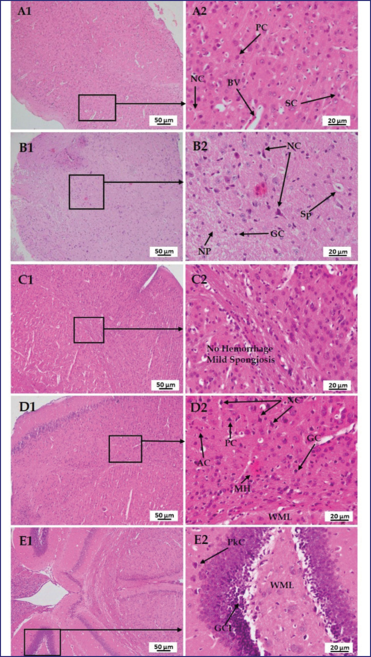 Figure 11.