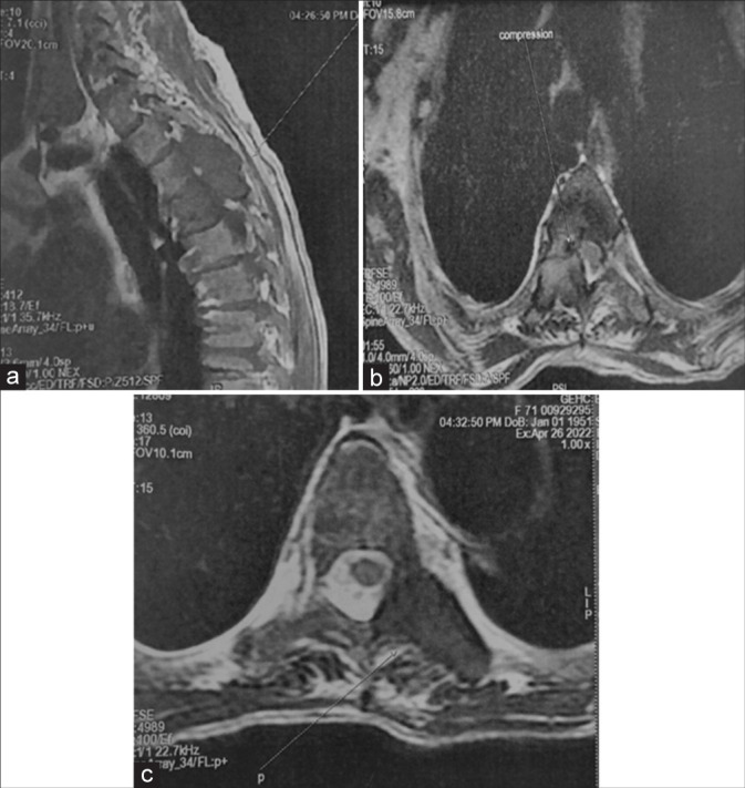 Figure 2: