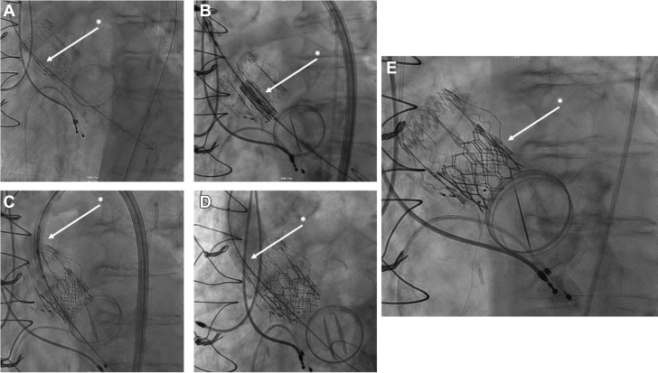 Figure 3