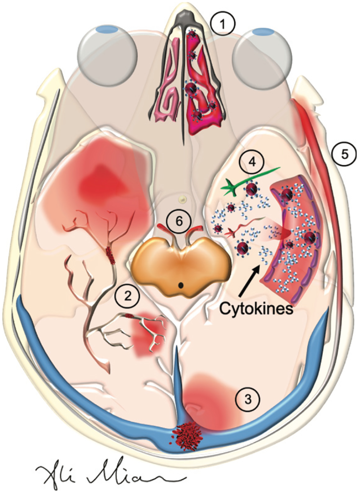 Fig. 2.