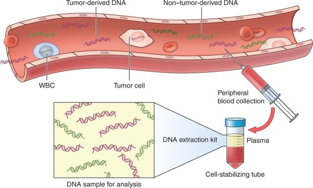 Figure 1. Tumor-derived cfDNA can be noninvasively detected from peripheral blood as a liquid biopsy. As a result of the physiologic processes of apoptosis, proliferation, and secretion, degraded DNA fragments are constantly released into the peripheral blood as cfDNA; cfDNA has a short half-life of only 1 to 2 hours before being cleared from plasma by the liver, spleen, and kidney. Patients with cancer have higher total body levels of cfDNA than healthy individuals, and the tumor-derived proportion of cfDNA is termed ctDNA—the most well-studied form of liquid biopsy for lymphoma. Liquid biopsies allow for noninvasive monitoring from peripheral blood collection in specialized cell-stabilizing tubes to minimize contamination from lysis of normal white blood cells (WBC). DNA can be extracted from plasma and analyzed for the presence of tumor-specific markers including immunoglobin gene rearrangements and lymphoma-specific genetic aberrations.