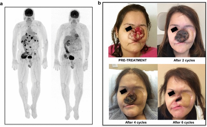 Fig. 2