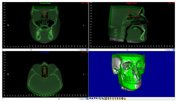 Figure 2