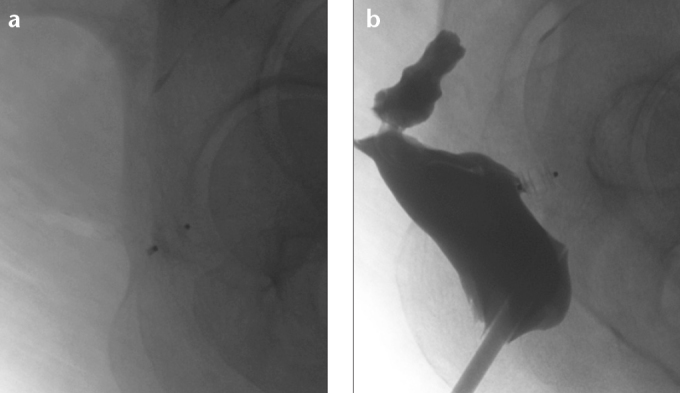 Figure 2. a,b.