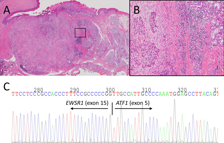 Fig. 3