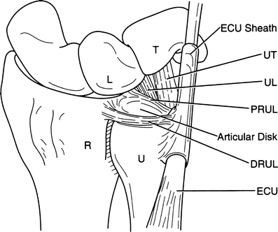 Fig. 13