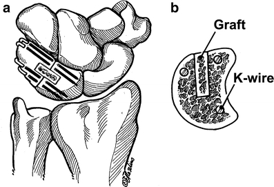 Fig. 21