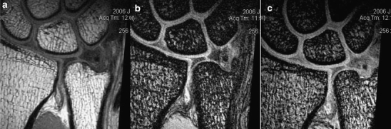 Fig. 3