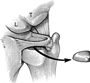 Fig. 16