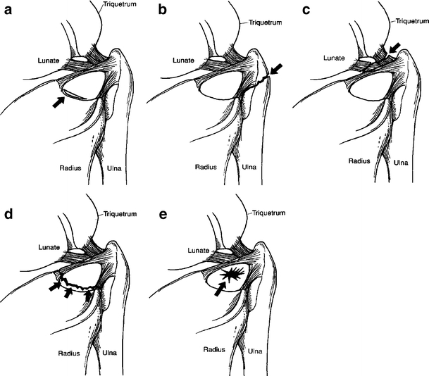 Fig. 14