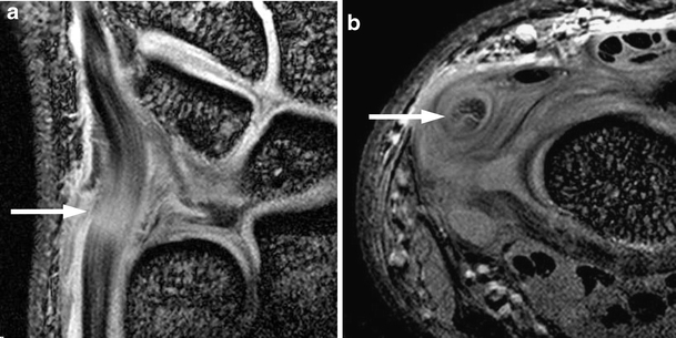 Fig. 8