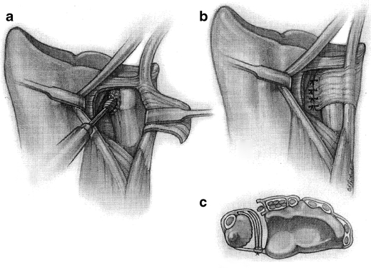 Fig. 17