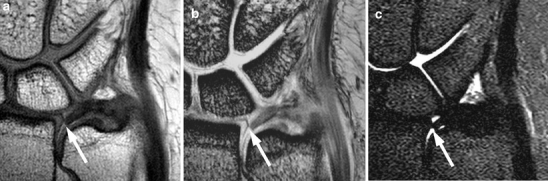 Fig. 7