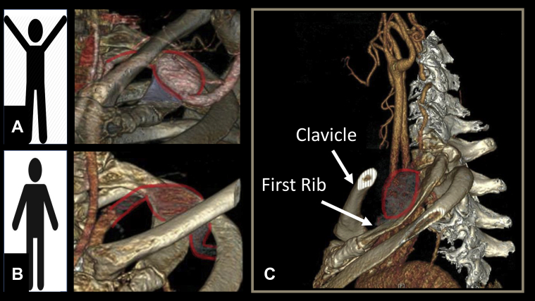 Fig 3