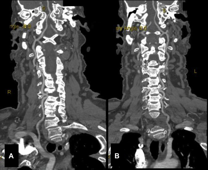 Fig 2