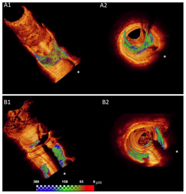 Fig. 2