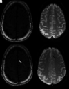 FIG 5.