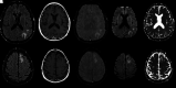 FIG 2.
