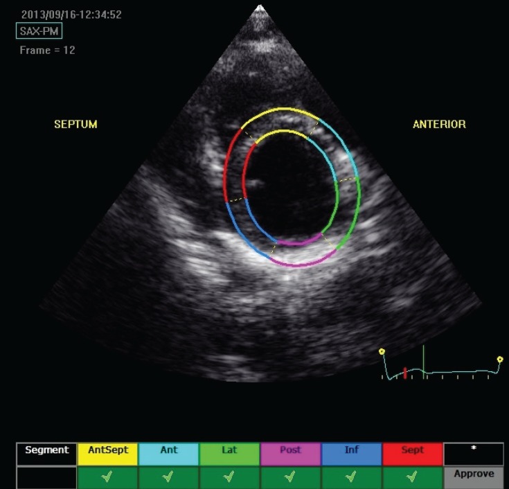 Fig. 4