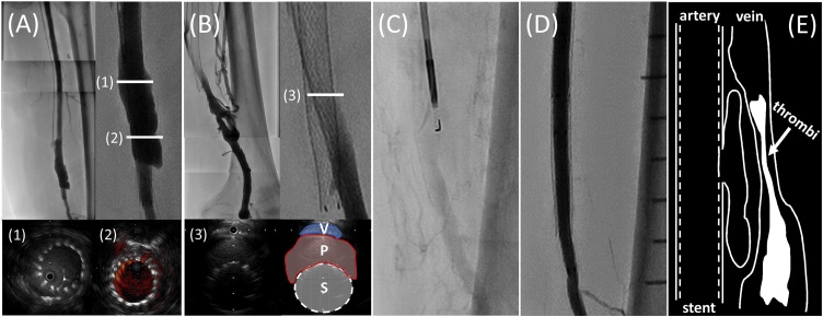 Fig. 3