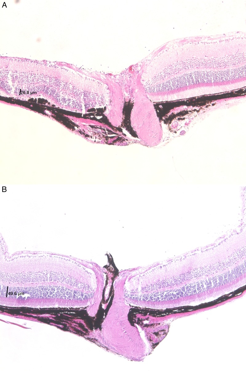 Figure 11. 