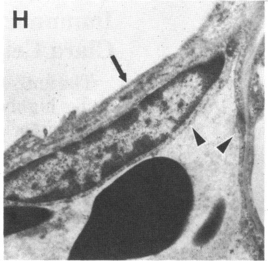 FIGURE 3. H