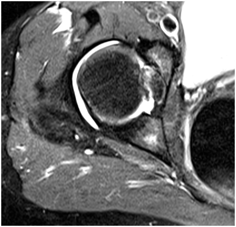 Fig. 6.