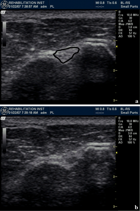Fig. 3