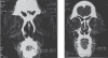 Figure 2 and 3