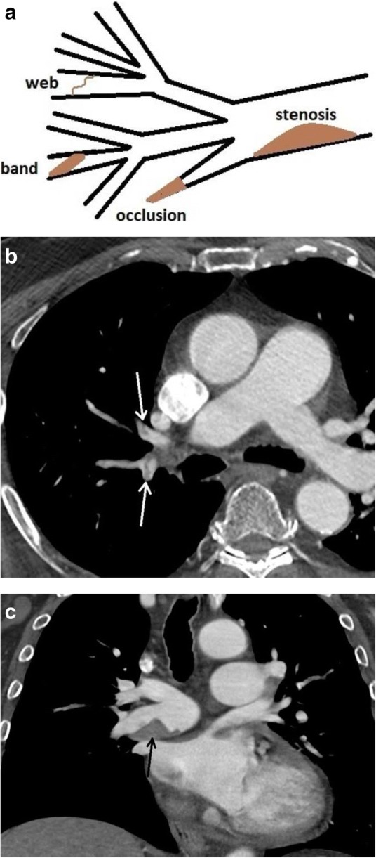 Fig. 20