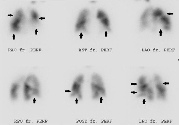 Fig. 18