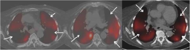 Fig. 19