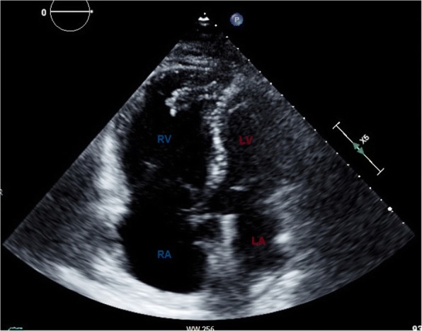 Fig. 17