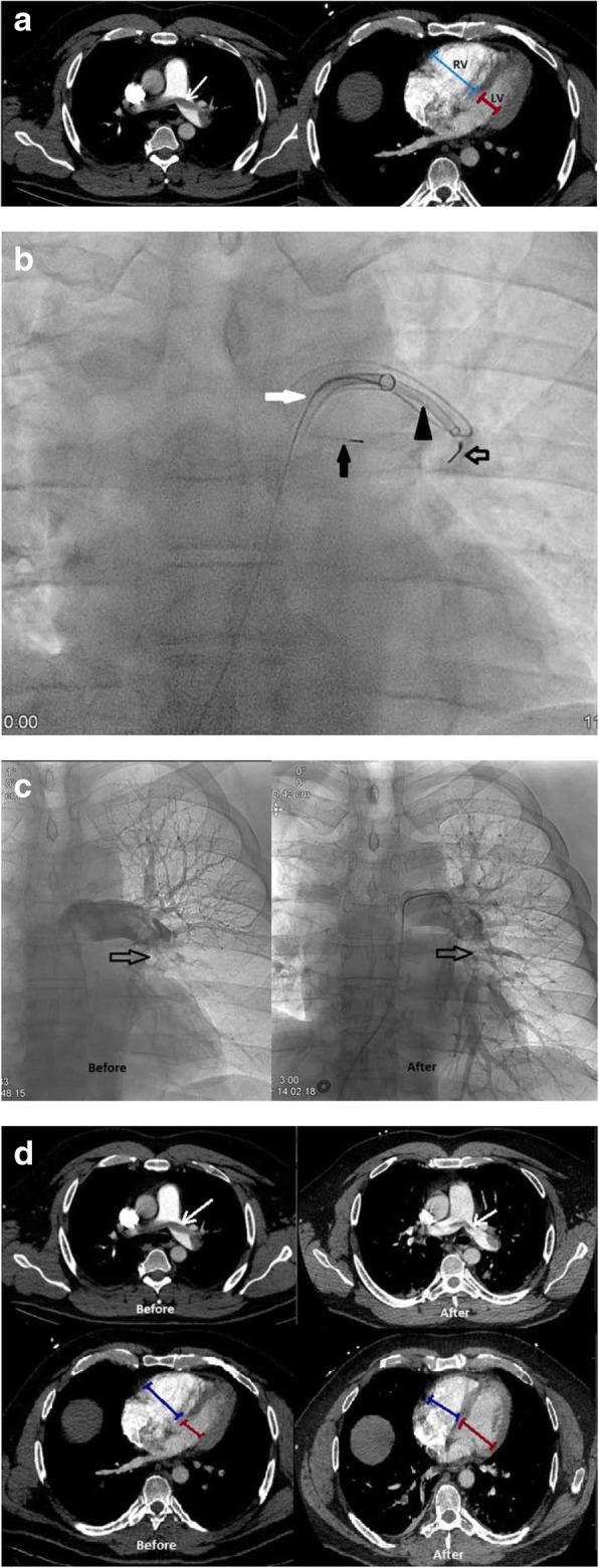 Fig. 11