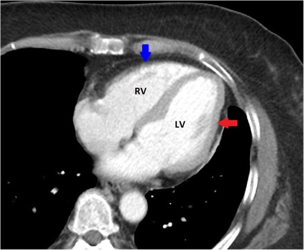 Fig. 1