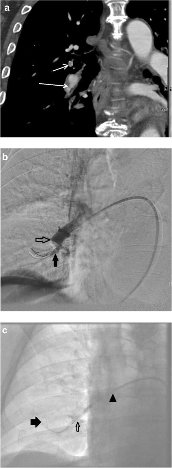 Fig. 24