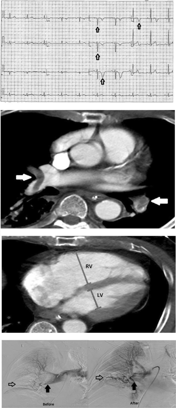 Fig. 12